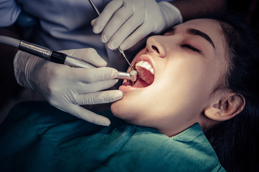 Everything You Need to Know About Dental Fillings - Types of Dental Fillings