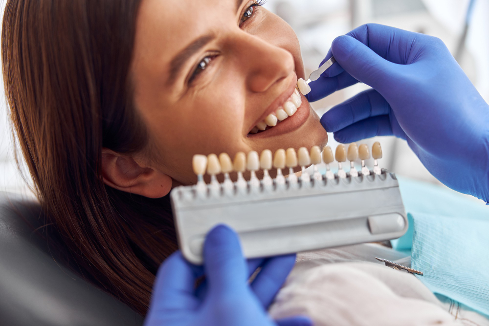 What Are Dental Veneers