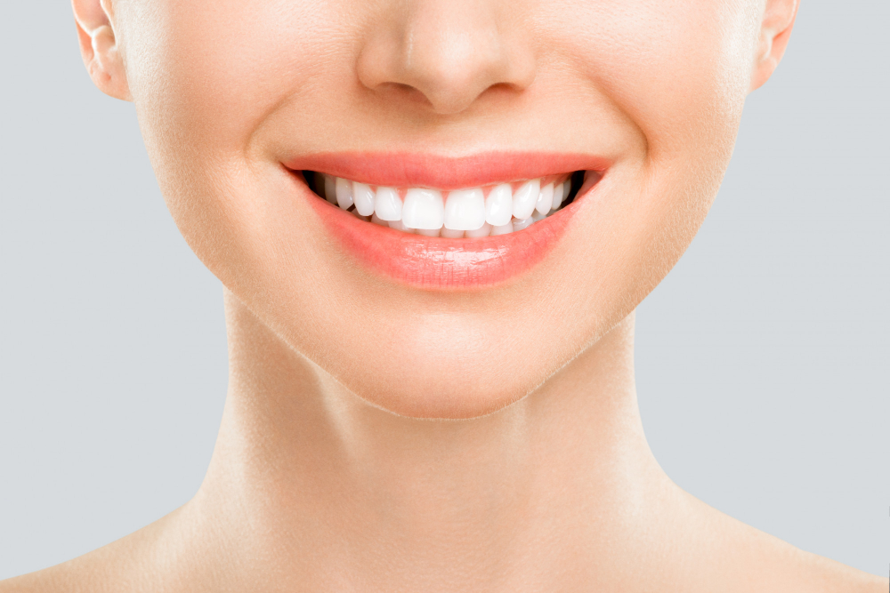 What Is Dental Bonding
